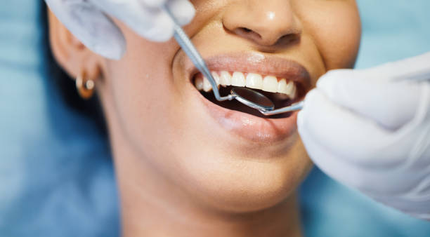 Best Emergency Broken Tooth Repair in Thomas, OK