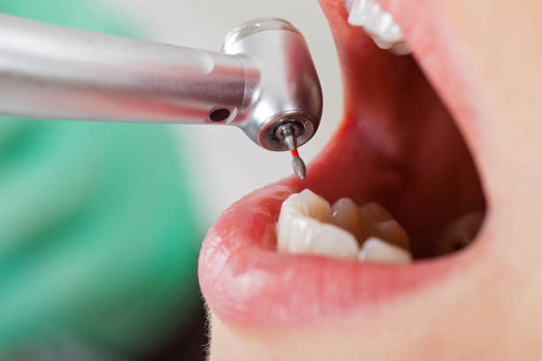Best Emergency Broken Tooth Repair in Thomas, OK